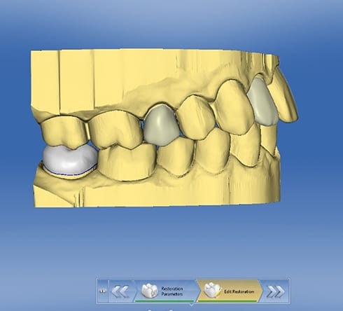 3 D image of smile impression