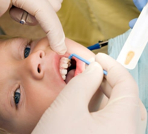 Child receiving fluoride treatment