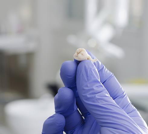 Hand holding an extracted tooth