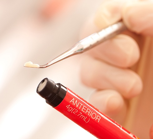 Gloved hands holding a tube of dental resin