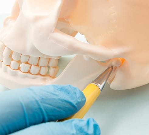 Skull and jaw bone model for T M J dysfunction treatment