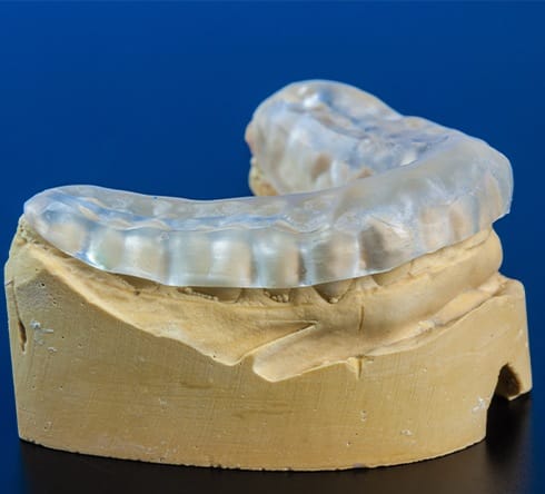 Model smile with oral splint in place