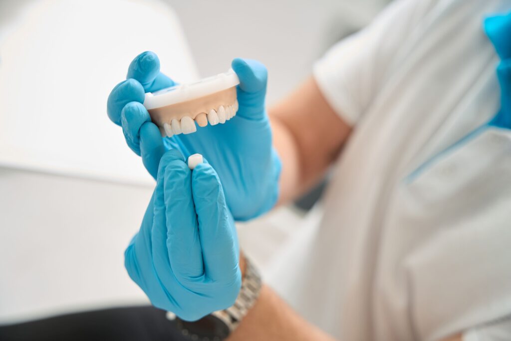 Gloved hands demonstrating dental crown over model tooth